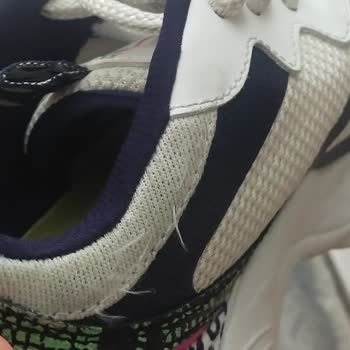 Skechers Ayakkabıların Haline Bakın