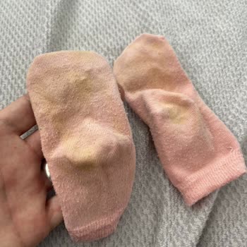 Ayakland (ayakland.com) Igor Marka Sandaletin Boya Sorunu Ve İlgisiz Müşteri Hizmetleri