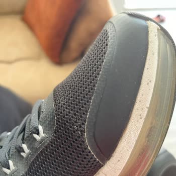 Skechers Ayakkabı Sorunu Ve İlgisizlik Hakkında