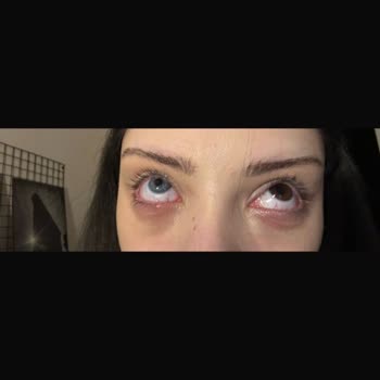 Labella Lensleri Gözüme Zarar Verdi