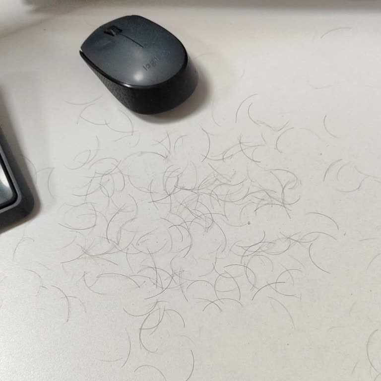 Özel Jimer Hastanesi Saç Ekiminden Sonra Ekilen Saçlar Dökülmeye Devam Ediyor