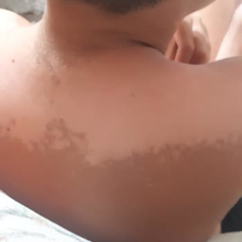 Trendyol Güneş Kremi Sahte