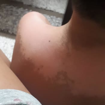 Trendyol Güneş Kremi Sahte