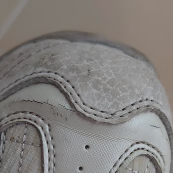 Skechers Ayakkabımın Birkaç Ayda Yıpranması, Hatayı Üstlenmeyen Firma