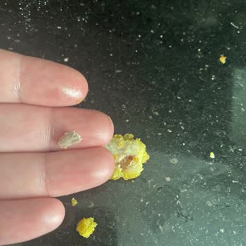 Keskinoğlu Nugget İçinden Kemik Çıktı