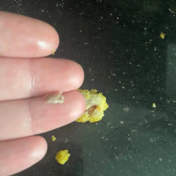 Keskinoğlu Nugget İçinden Kemik Çıktı