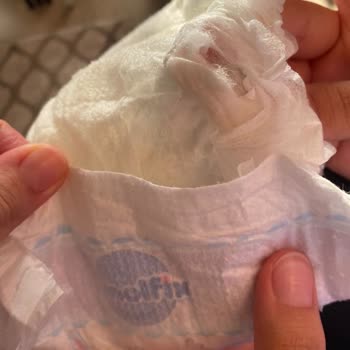 Molfix Marka Bezin İçinden Sakız Çıkması