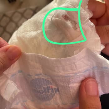 Molfix Marka Bezin İçinden Sakız Çıkması