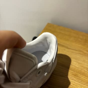 Adidas Ayakkabı Arkası Vuruyor