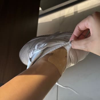 Adidas Ayakkabı Arkası Vuruyor