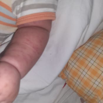 Antalya Şehir Hastanesi Çocuk Acil Bölümü