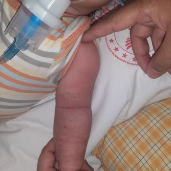 Antalya Şehir Hastanesi Çocuk Acil Bölümü