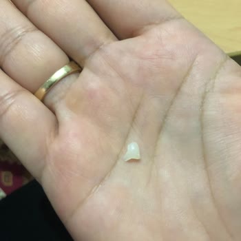 Tatbak Gıda Pastada Yabancı Cisim