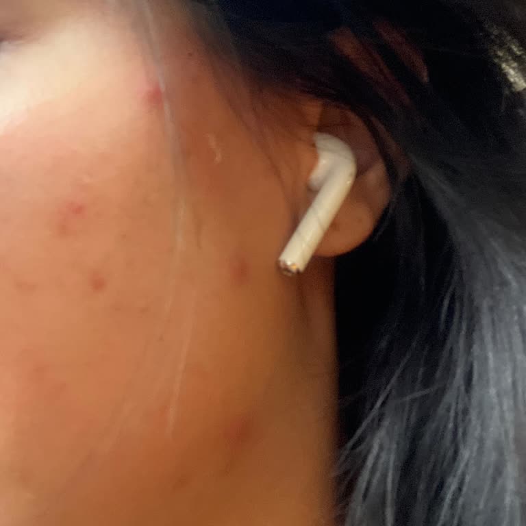 Loreal Paris Nem Terapi Şikayeti