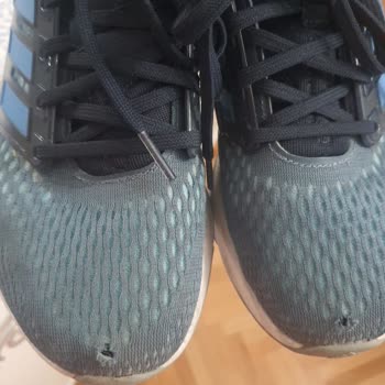 Adidas Ayakkabı Yırtıldı 3 Ayda Kullanıcı Hatası Dediler