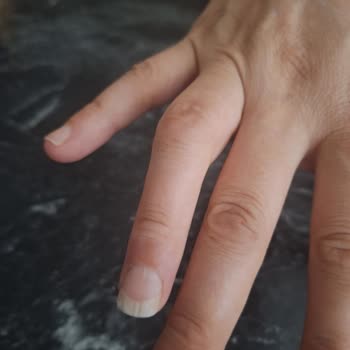 Kayseri Acıbadem Hastanesi İşe Yaramayan İki Ameliyat