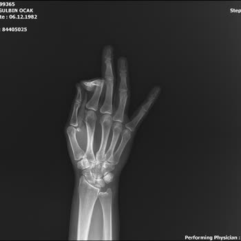 Kayseri Acıbadem Hastanesi İşe Yaramayan İki Ameliyat