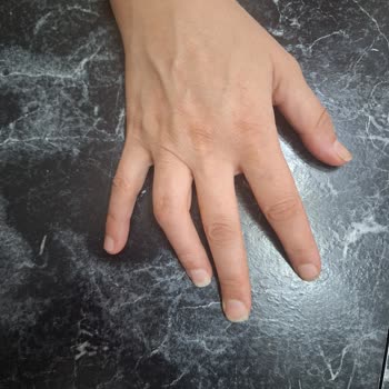 Kayseri Acıbadem Hastanesi İşe Yaramayan İki Ameliyat