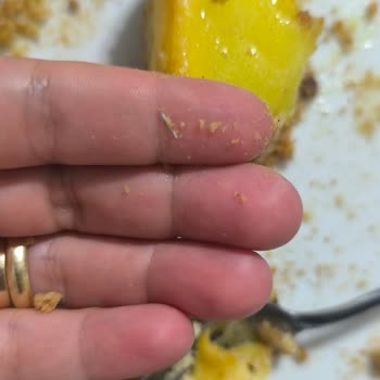 Özsüt Marketten Alınan Kekten Yabancı Cisim Çıktı