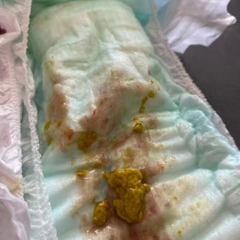 Bayat Mama Çocuğumu Perişan Etti Bunun Suçlusu Market Mi Nestle Mi