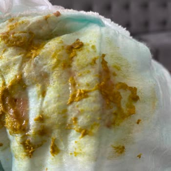 Bayat Mama Çocuğumu Perişan Etti Bunun Suçlusu Market Mi Nestle Mi