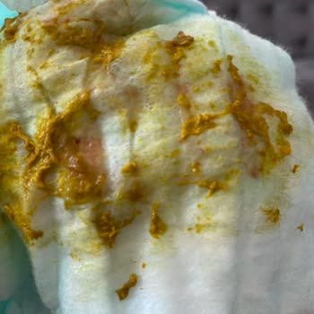 Bayat Mama Çocuğumu Perişan Etti Bunun Suçlusu Market Mi Nestle Mi