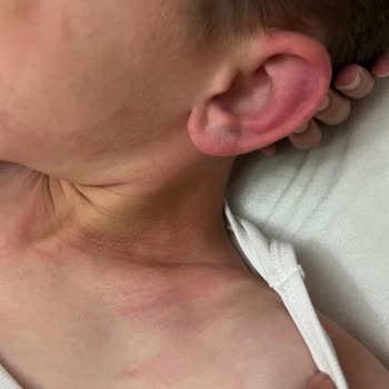 Danone Meyveli Yoğurt Sonrası