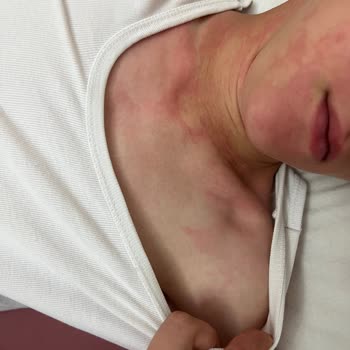 Danone Meyveli Yoğurt Sonrası