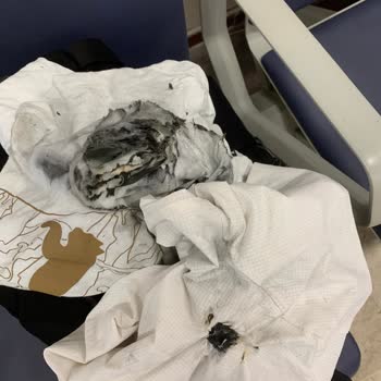 Pegasus Hava Yolları Çanta Faciası