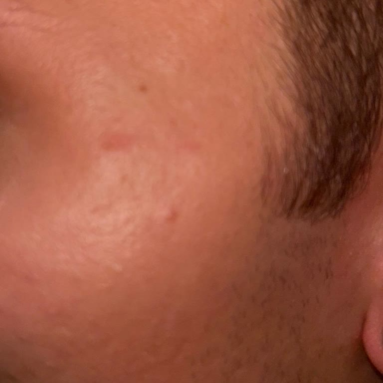 McDonald's 'ta Çalışan Tokat Attı