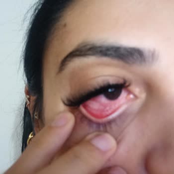 Fahra Life & Güzellik Salonu Göz Sağlığımı Tehlikeye Atan İpek Kirpik Deneyimi