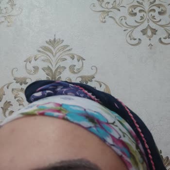 İbrahim Kale (Gaziantep) Microblading Kaş Rengi Sorunu: Koyu Ve Doğal Olmayan Sonuç