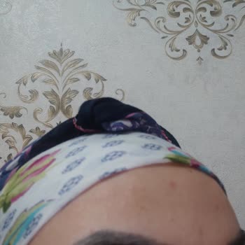 İbrahim Kale (Gaziantep) Microblading Kaş Rengi Sorunu: Koyu Ve Doğal Olmayan Sonuç