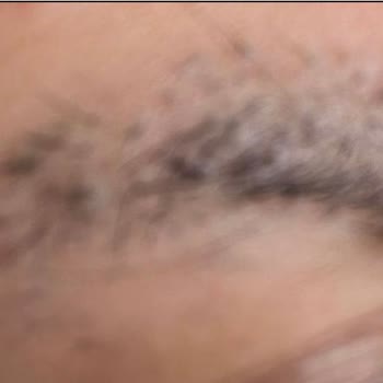 Anatolia Saç Ekim Merkezinde Hayal Kırıklığı