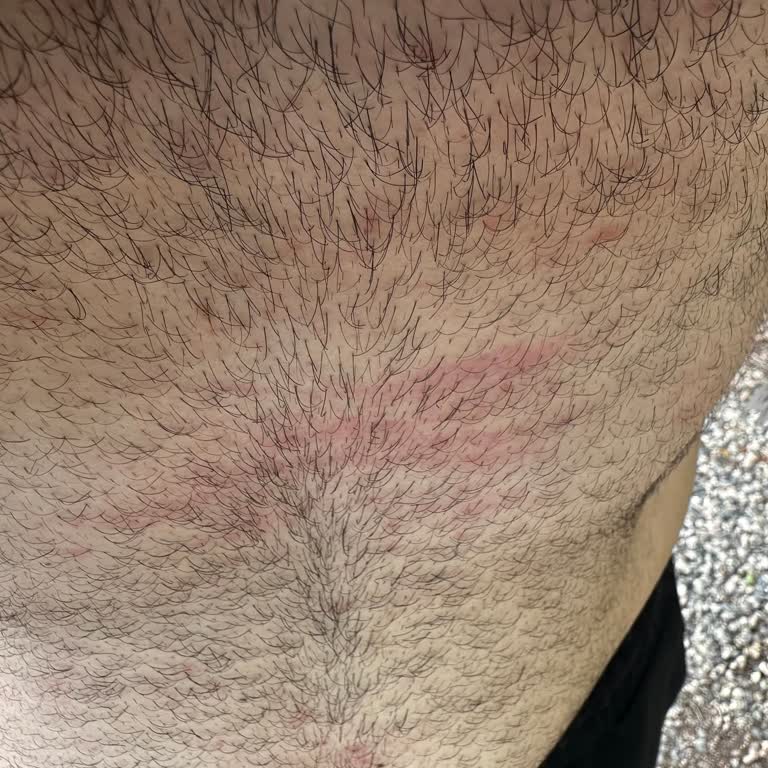 Le Petit Marseillais Organik Vanilya Özlü Duş Jeli Kullanımında Yaşanan Alerjik Reaksiyonlar