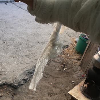 Kapaklı Devlet Hastanesi Alçıyı Düzgün Yapamadılar