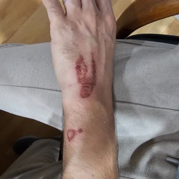 Onvo RX-05 Motor Freni Öne Yumulma Sorunu!