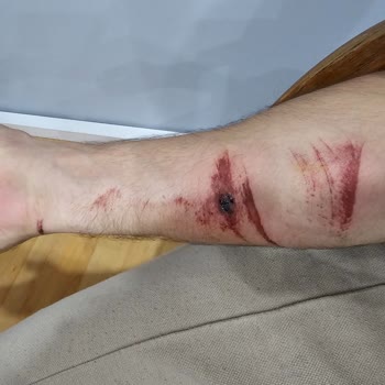 Onvo RX-05 Motor Freni Öne Yumulma Sorunu!