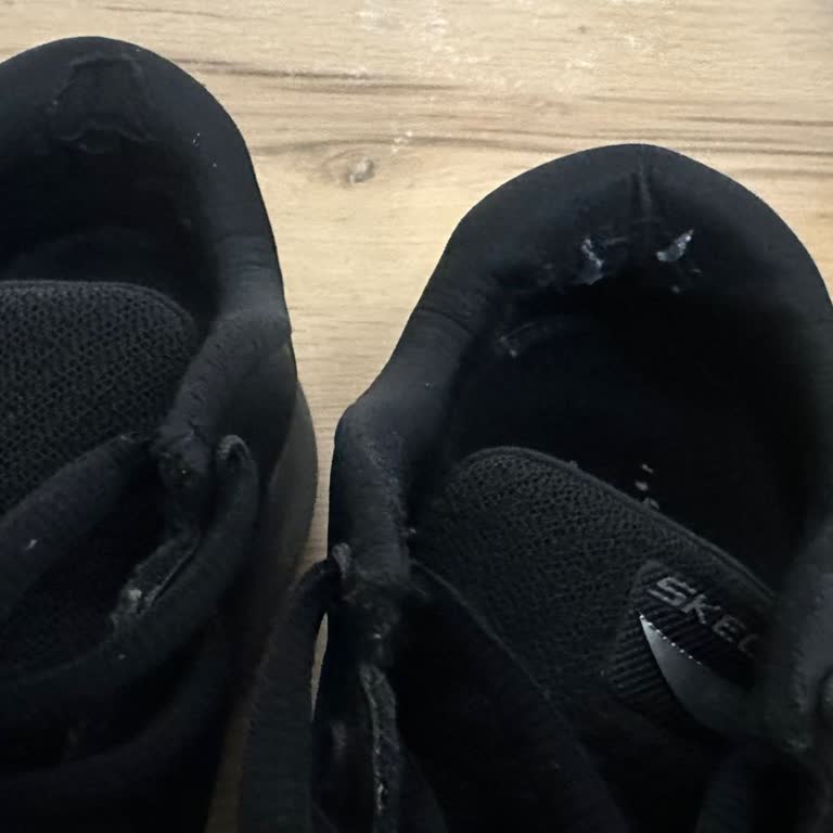 Skechers Ayakkabı Kalitesizliği Ve Dayanıksızlığı