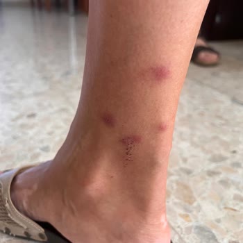 Akgünler Denizcilik Akgünler Gemi Tahtakurusu