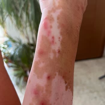 Akgünler Denizcilik Akgünler Gemi Tahtakurusu