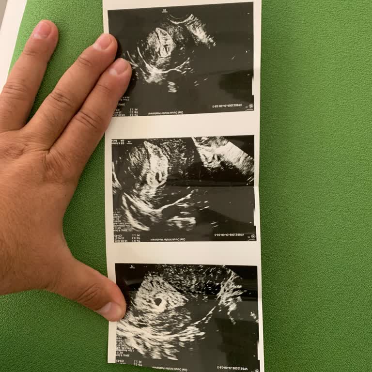 Doruk Nilüfer Hastanesi Doktor İlgisizliği