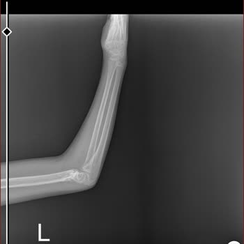 Yozgat Bozok Üniversitesi Ortopedi Doktorları Sıkıntı
