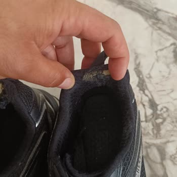 Skechers Ayakkabıda 4 Ayda Açılma Sorunu