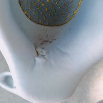 Adidas Ayakkabı Yırtılması Ve Sökülmesi