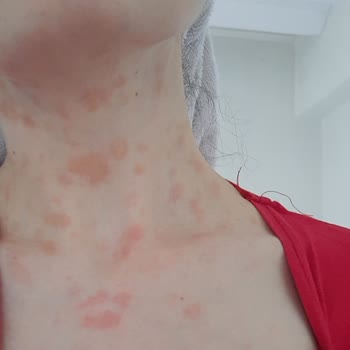 Le Petit Marseillais La Petit Marseillais Çilek Aromalı Duş Jeli Alerji Yaptı