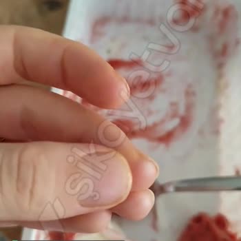 Akdo Pastaneleri İçerisinden Cam Parçası Çıktı!