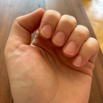 Beauty Port Kayseri Kayseri Hayal Kırıklığı