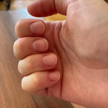 Beauty Port Kayseri Kayseri Hayal Kırıklığı