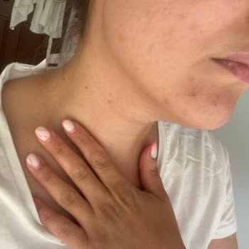 Yves Roche Güneş Kremi